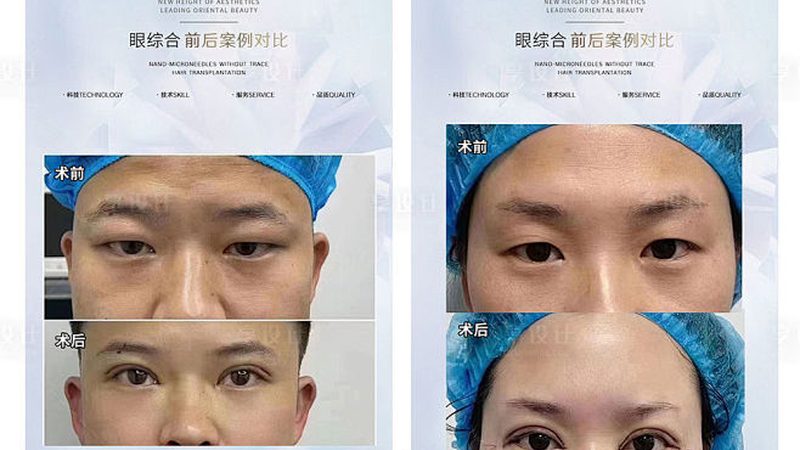揭秘水光针：研发实验室实力背后的秘密