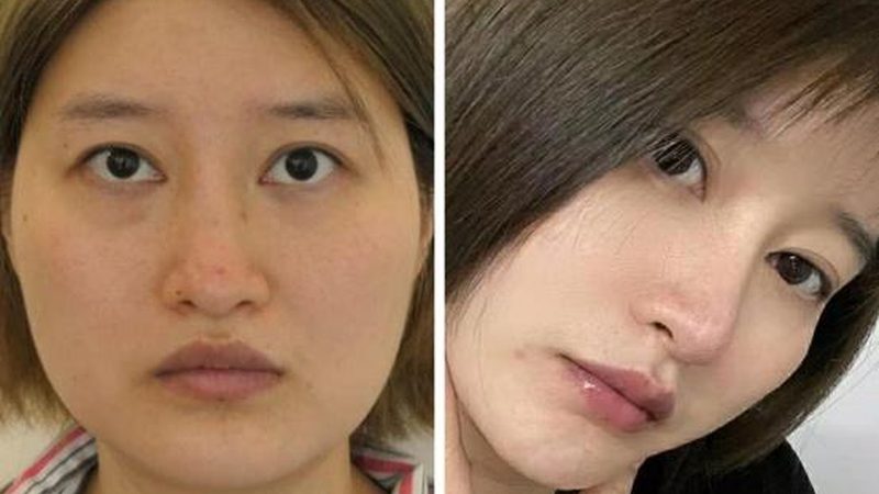 瘦脸精华液和V脸面膜对比