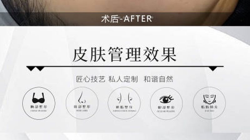 小标题：局麻手术的恢复周期和费用