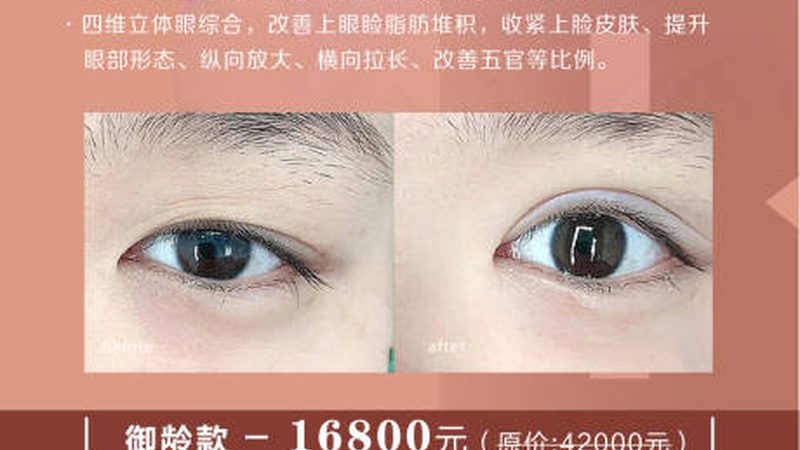 美容院超声刀：便捷但专业度有限