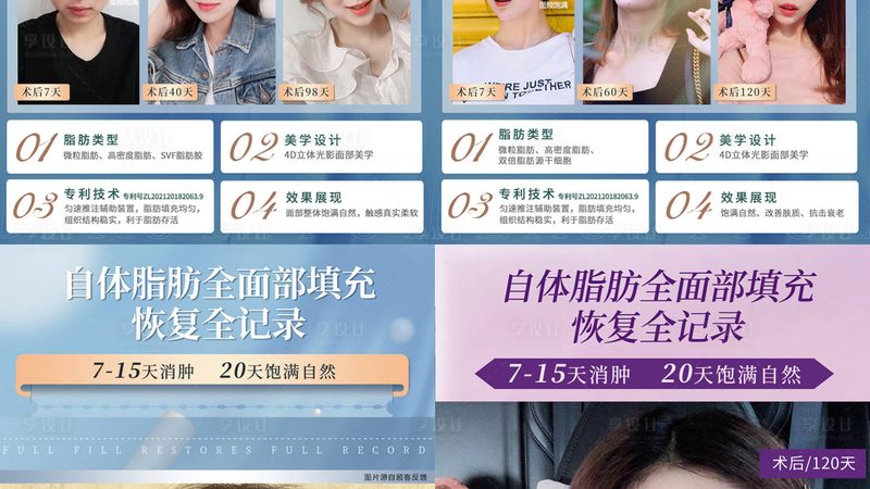 开眼角手术，如何选择专业医院？**