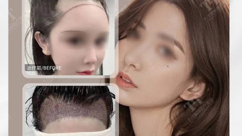 皮肤管理仪器定制：从贴牌到研发，行业正在经历什么