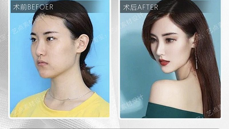 整形医院激光美容科室加盟