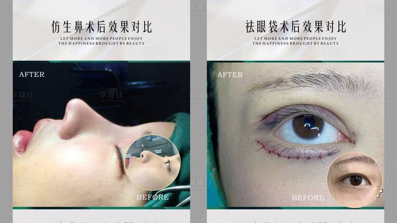 热玛吉厂家选择，避开这五个常见认知偏差