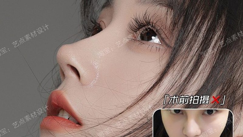 成都隆鼻假体，如何甄别品质与安全？**