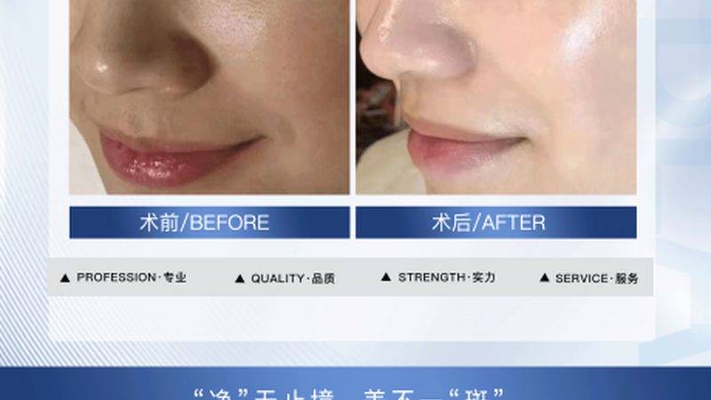 轻医美和生美加盟对比