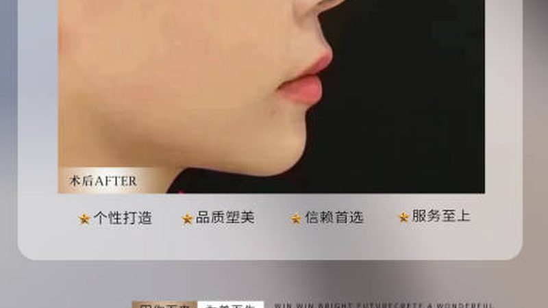 南京皮肤美容整形医院：口碑背后的技术解读与选择要点