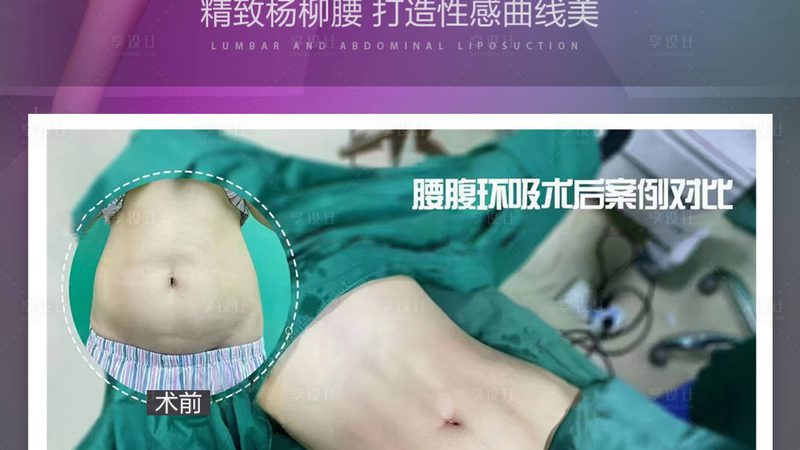 激光祛斑仪器生产厂家哪家好