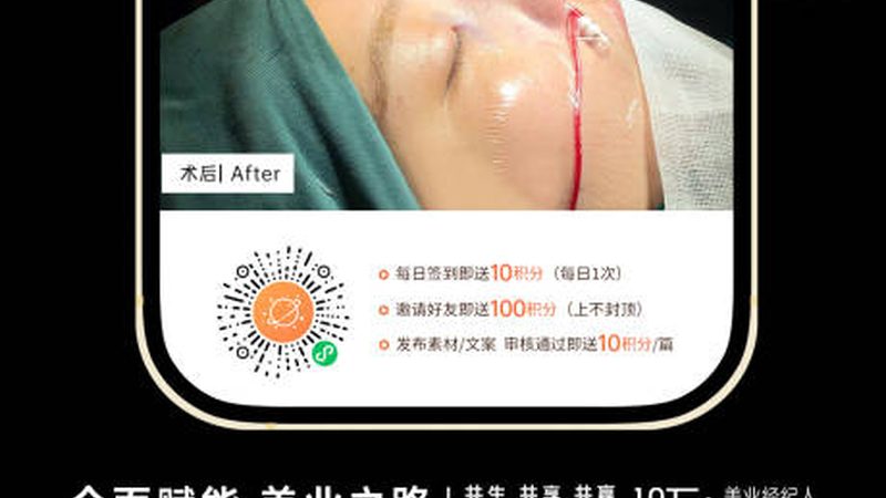 小标题：售后服务的重要性