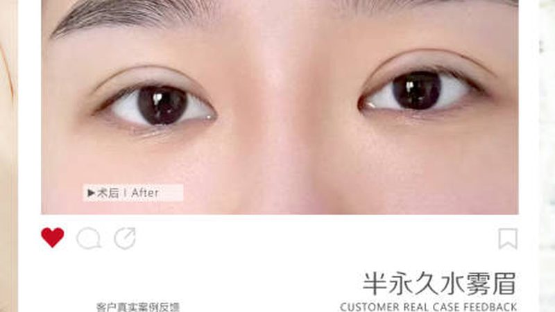 玻尿酸护肤品定制贴牌：揭秘定制化护肤新趋势