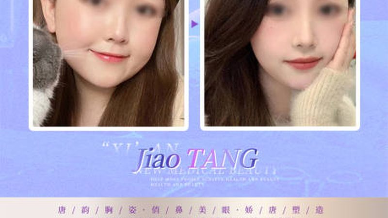 光子嫩肤家用仪器怎么选