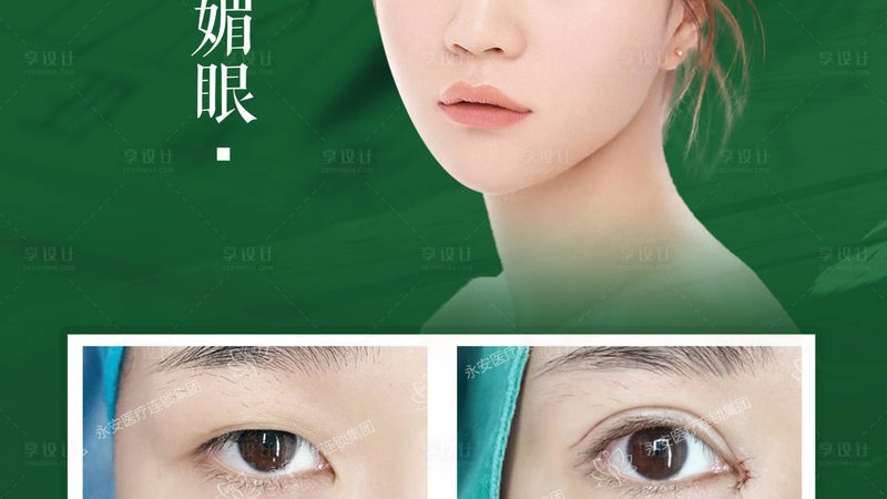 鼻头鼻翼整形，价格背后的考量因素**