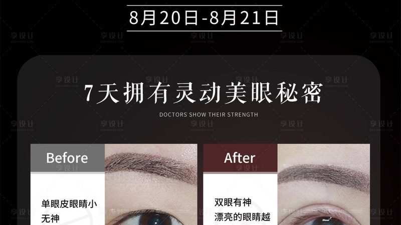 肉毒素治疗斜视，揭秘手术步骤与注意事项