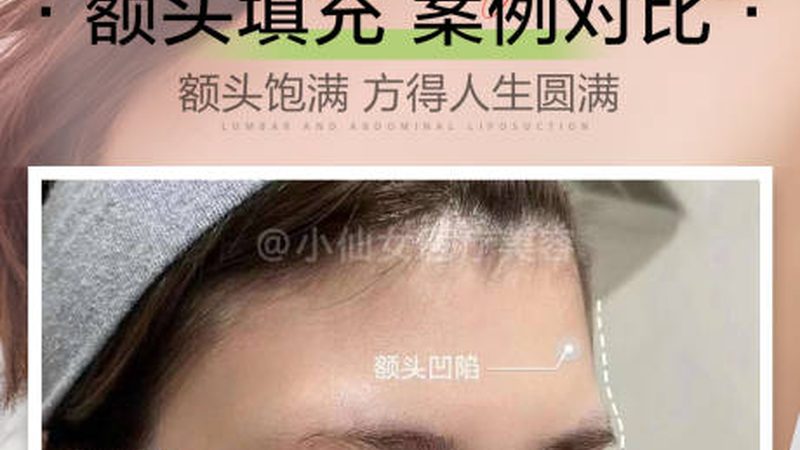 瘦脸操前后，这些产品你不可不知