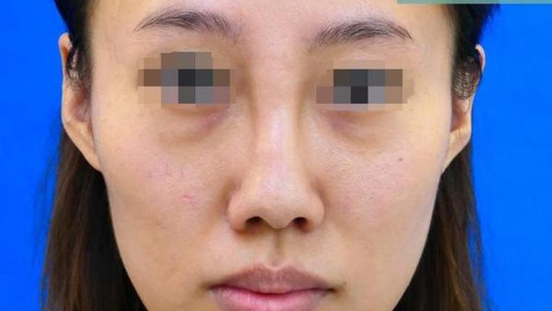注射美容价格与医院等级：揭秘背后的真相
